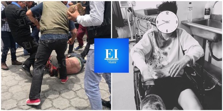 En Madrid, un joven fue brutalmente golpeado por varios hombres que lo hicieron pasar por ladrón, pide justicia y ayuda